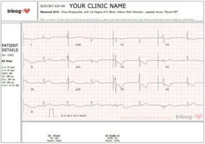 Tricog Health Services / Cygnus